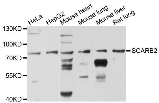 Western blot - SCARB2 antibody (144-12723)