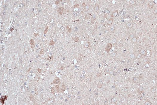 Immunohistochemistry - MAP1LC3B Polyclonal Antibody (144-07198)