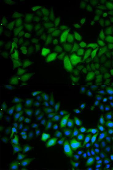 Immunofluorescence - TK1 antibody (144-05612)