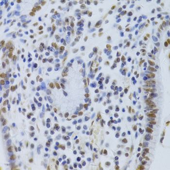 Immunohistochemistry - XRCC5 Antibody (144-05862)