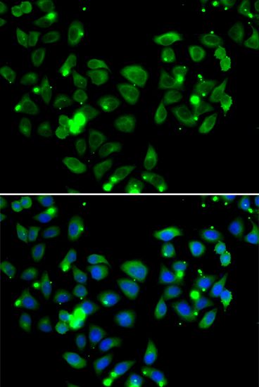 Immunofluorescence - CARD11 antibody (144-07140)
