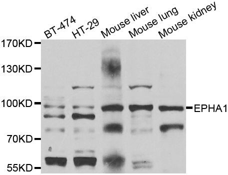 Western blot - EPHA1 antibody (144-07328)