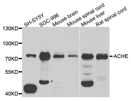 Western blot - ACHE antibody (144-02806)