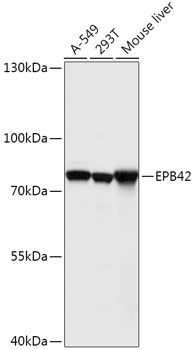 Western blot