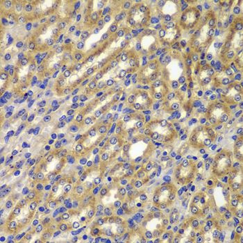 Immunohistochemistry - CCNA2 antibody (144-07632)