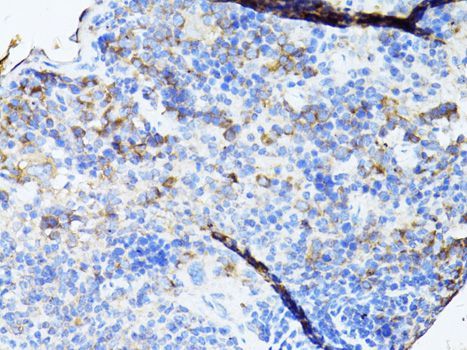Immunohistochemistry - TEFM Polyclonal Antibody (144-08511)