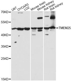 Western blot - TMEM25 antibody (144-60652)