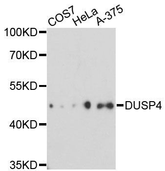 Western blot - DUSP4 Polyclonal Antibody (144-02726)