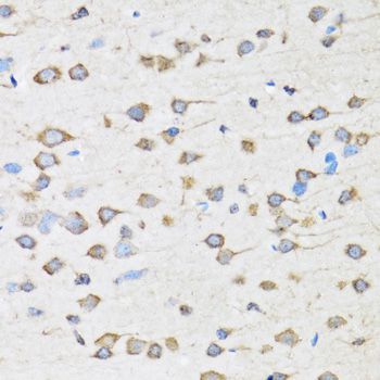 Immunohistochemistry - COPB2 Polyclonal Antibody (144-07036)