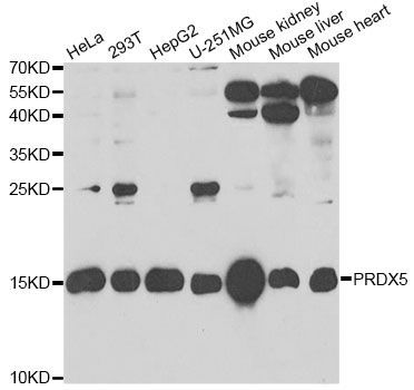Western blot - PRDX5 Polyclonal Antibody (144-06329)