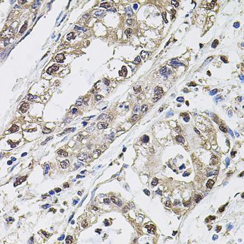 Immunohistochemistry - CA9 Polyclonal Antibody (144-60443)