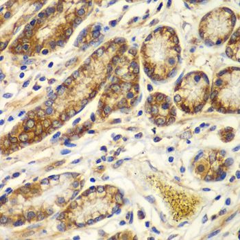 Immunohistochemistry - CAPNS1 antibody (144-06539)