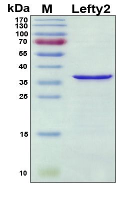 SDS-PAGE
