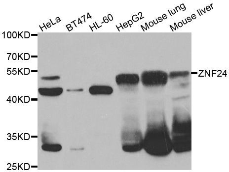 Western blot - ZNF24 antibody (144-07500)