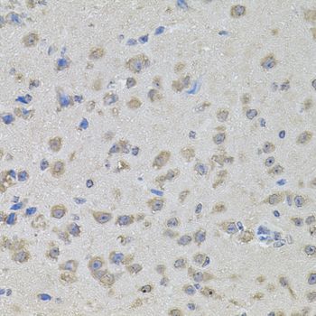 Immunohistochemistry - MAPK1 Polyclonal Antibody (144-011186)