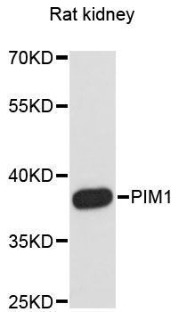 Western blot - PIM1 Polyclonal Antibody (144-60012)