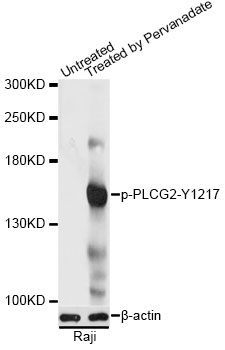 Western blot - Phospho-PLCG2-Y1217 pAb (144-61529)