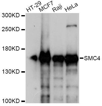 Western blot - SMC4 antibody (144-60525)