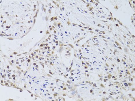 Immunohistochemistry - FKBP4 Polyclonal Antibody (144-05643)
