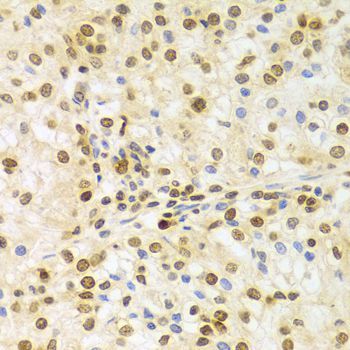 Immunohistochemistry - ELAVL1 Polyclonal Antibody (144-01608)