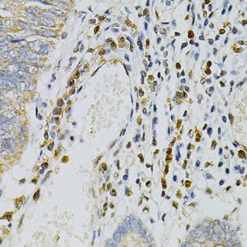 Immunohistochemistry - CDA Polyclonal Antibody (144-013959)