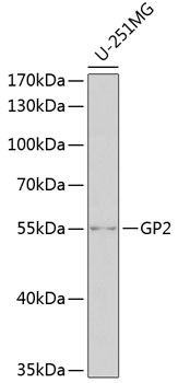 Western blot