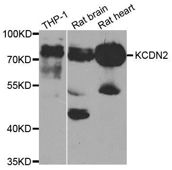 Western blot - KCND2 Polyclonal Antibody (144-06203)