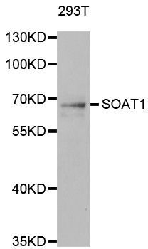 Western blot - SOAT1 Polyclonal Antibody (144-06311)