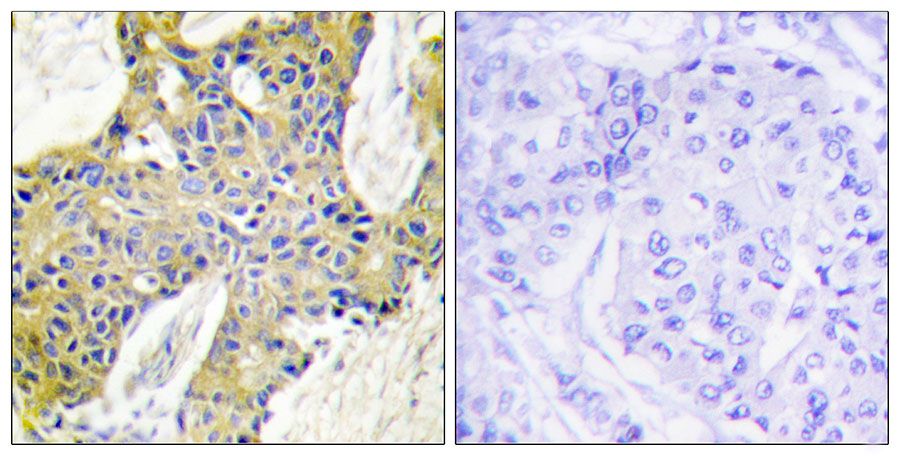 IHC