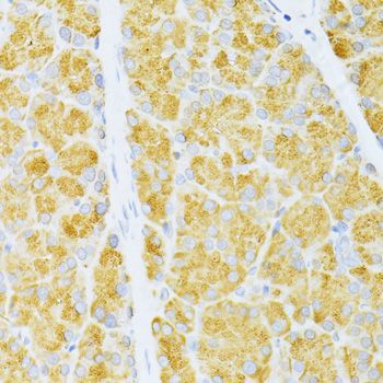 Immunohistochemistry - FLT3 antibody (144-012437)
