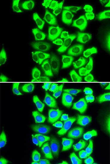 Immunofluorescence - RPS3A Polyclonal Antibody (144-05885)