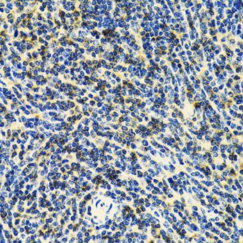 Immunohistochemistry - CD3E Polyclonal Antibody (144-01753)