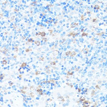 Immunohistochemistry - FGFR2 antibody (144-02074)