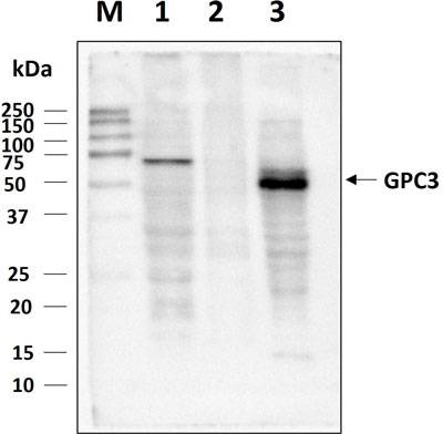 Western blot