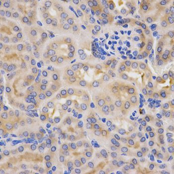 Immunohistochemistry - CFB antibody (144-01706)
