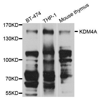 Western blot - KDM4A Polyclonal Antibody (144-07953)