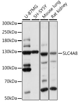Western blot - SLC4A8 Polyclonal Antibody (144-60811)