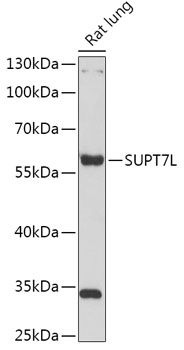 Western blot