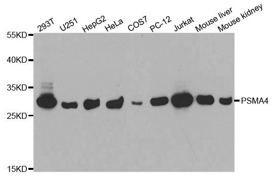 Western blot - PSMA4 Polyclonal Antibody (144-02511)