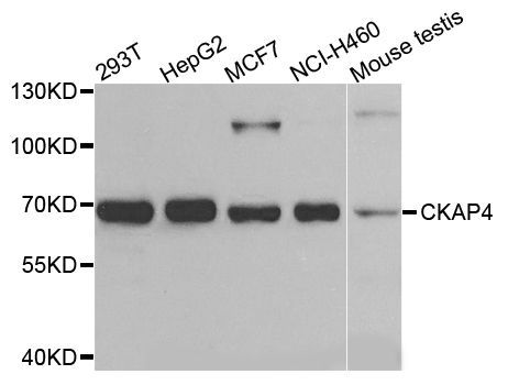 Western blot - CKAP4 Polyclonal Antibody (144-07777)