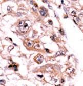 IHC-P