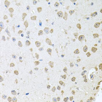 Immunohistochemistry - TARS antibody (144-06993)
