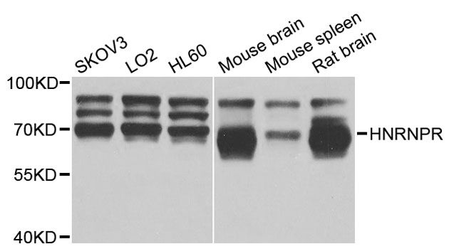 Western blot - HNRNPR antibody (144-05883)