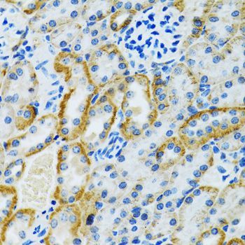 Immunohistochemistry - GDAP1 antibody (144-06601)