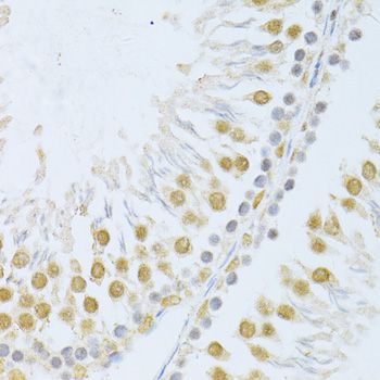 Immunohistochemistry - POLR2A Polyclonal Antibody (144-011181)