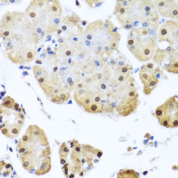 Immunohistochemistry - NUMA1 Polyclonal Antibody (144-00527)