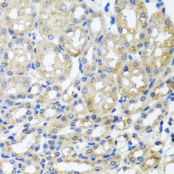 Immunohistochemistry - ST8SIA2 antibody (144-07748)