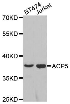 Western blot - ACP5 antibody (144-02528)