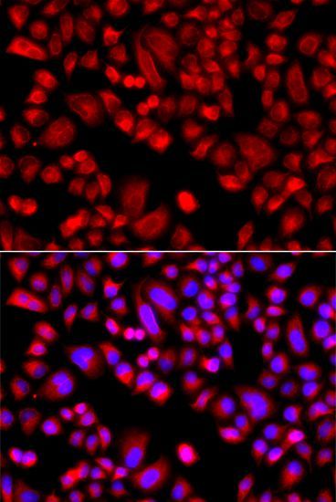 Immunofluorescence - ARPC3 antibody (144-07767)