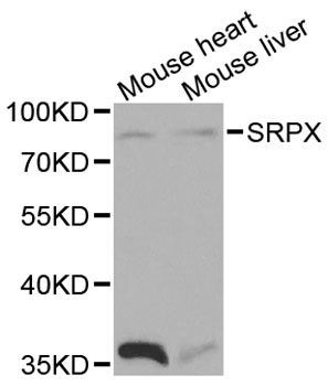 Western blot - SRPX antibody (144-01217)